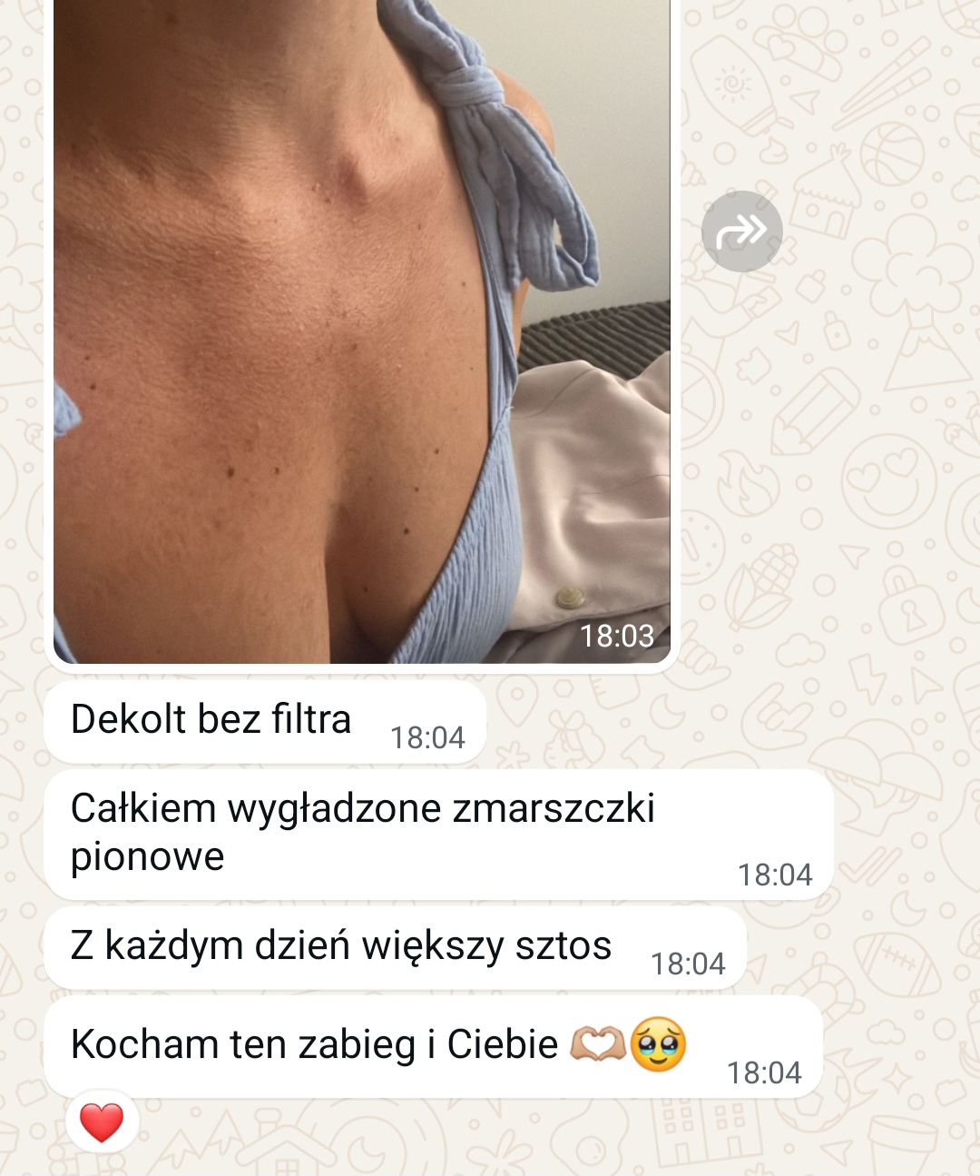 opinia 1